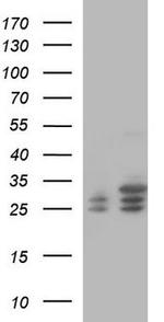 CLNS1A Antibody in Western Blot (WB)