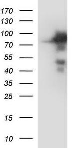 IL4 Receptor alpha Antibody in Western Blot (WB)