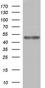 Protein C inhibitor Antibody in Western Blot (WB)