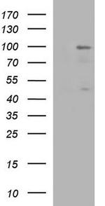 PMS2 Antibody in Western Blot (WB)