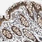 FANCC Antibody in Immunohistochemistry (IHC)