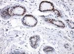 ER Antibody in Immunohistochemistry (Paraffin) (IHC (P))