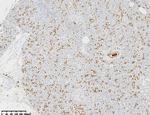 HNF1-Beta (HNF1B) Antibody in Immunohistochemistry (Paraffin) (IHC (P))