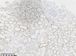 HNF1-Beta (HNF1B) Antibody in Immunohistochemistry (Paraffin) (IHC (P))