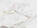 E-Cadherin (CDH1) Antibody in Immunohistochemistry (Paraffin) (IHC (P))