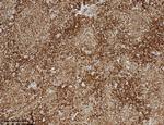 BCL2 Antibody in Immunohistochemistry (Paraffin) (IHC (P))