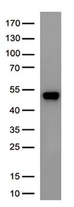 SARS-CoV-2 N Protein Antibody in Western Blot (WB)