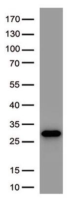 SARS-CoV-2 Spike Protein Antibody in Western Blot (WB)