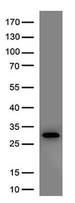 SARS-CoV-2 Spike Protein Antibody in Western Blot (WB)