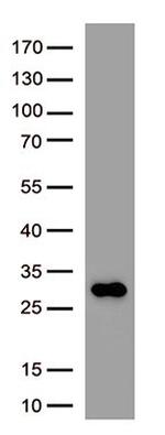 SARS-CoV-2 Spike Protein Antibody in Western Blot (WB)