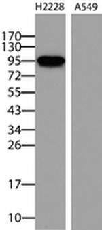 ALK Antibody in Western Blot (WB)