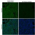 VIM Antibody in Immunohistochemistry (Paraffin) (IHC (P))