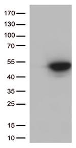 CDK15 Antibody in Western Blot (WB)