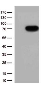 CSF2RA Antibody in Western Blot (WB)