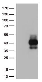 TIGIT Antibody in Western Blot (WB)