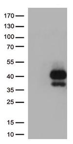 TIGIT Antibody in Western Blot (WB)