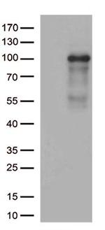 ADAM28 Antibody in Western Blot (WB)