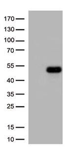 ATF4 Antibody in Western Blot (WB)