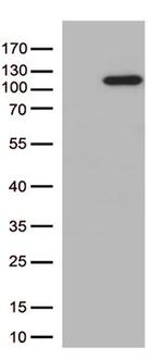 ERAP1 Antibody in Western Blot (WB)