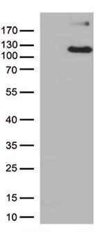 ERAP1 Antibody in Western Blot (WB)