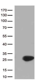 CYGB Antibody in Western Blot (WB)