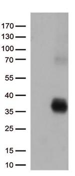 HLA-DQA2 Antibody in Western Blot (WB)