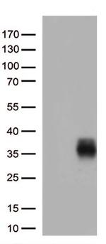 HLA-DQA2 Antibody in Western Blot (WB)