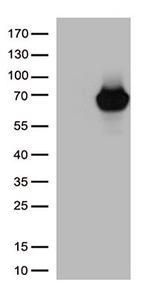 ARSB Antibody in Western Blot (WB)