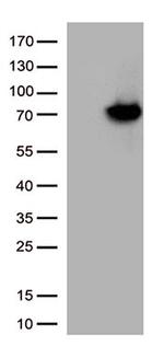 ARSB Antibody in Western Blot (WB)