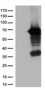 USH1C Antibody in Western Blot (WB)