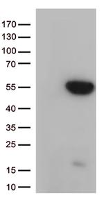 GNAL Antibody in Western Blot (WB)
