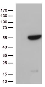 GNAL Antibody in Western Blot (WB)