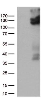 TRPV2 Antibody in Western Blot (WB)