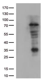 Lymphocyte Activation Gene 3 (LAG3) Antibody in Western Blot (WB)
