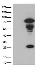 Lymphocyte Activation Gene 3 (LAG3) Antibody in Western Blot (WB)