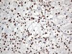 EWSR1 Antibody in Immunohistochemistry (Paraffin) (IHC (P))