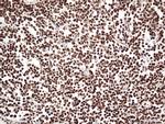 EWSR1 Antibody in Immunohistochemistry (Paraffin) (IHC (P))