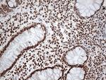 EWSR1 Antibody in Immunohistochemistry (Paraffin) (IHC (P))