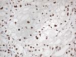 EWSR1 Antibody in Immunohistochemistry (Paraffin) (IHC (P))