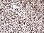 EWSR1 Antibody in Immunohistochemistry (Paraffin) (IHC (P))