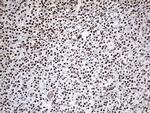EWSR1 Antibody in Immunohistochemistry (Paraffin) (IHC (P))