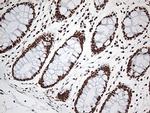 EWSR1 Antibody in Immunohistochemistry (Paraffin) (IHC (P))