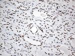 EWSR1 Antibody in Immunohistochemistry (Paraffin) (IHC (P))