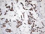 EWSR1 Antibody in Immunohistochemistry (Paraffin) (IHC (P))