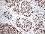EWSR1 Antibody in Immunohistochemistry (Paraffin) (IHC (P))