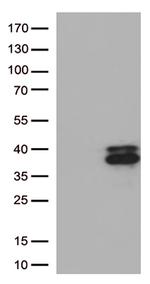 Major Basic Protein (PRG2) Antibody in Western Blot (WB)