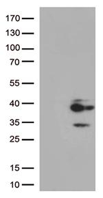Major Basic Protein (PRG2) Antibody in Western Blot (WB)