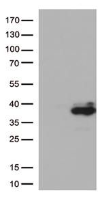 Major Basic Protein (PRG2) Antibody in Western Blot (WB)