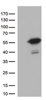 MTRF1 Antibody in Western Blot (WB)
