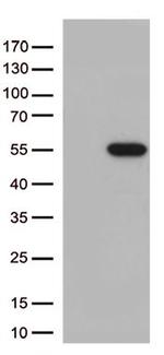 MTRF1 Antibody in Western Blot (WB)